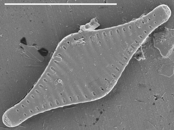 Pseudostaurosira parasitica SEM4