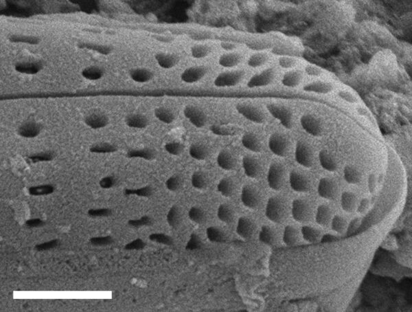 Rhoicosphenia californica SEM3