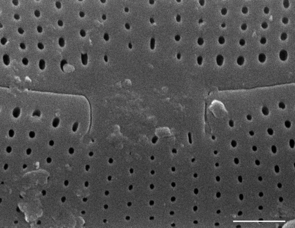 Frustulia creuzburgensis SEM1