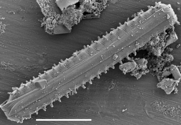 Staurosirella berolinensis SEM1