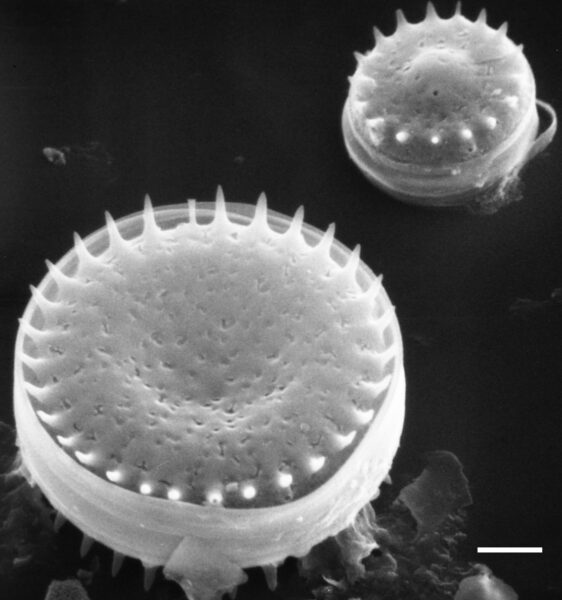 Stephanodiscus minutulus SEM3