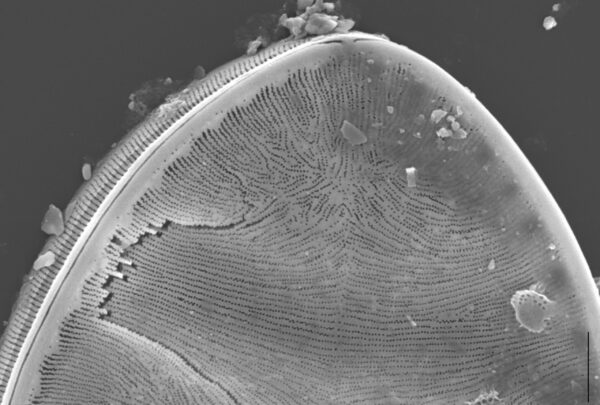 Surirella Undulata Sem 1