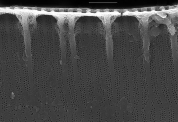 Surirella suecica SEM1