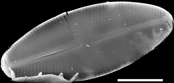 Psammothidium lacustre SEM1