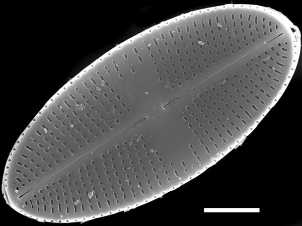 Psammothidium nivale SEM1