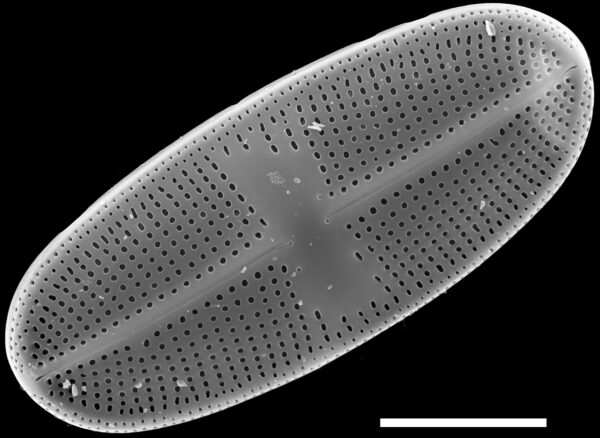 Psammothidium alpinum SEM2