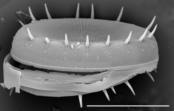 Stephanodiscus yellowstonensis SEM3