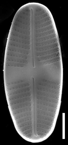 Psammothidium lauenburgianum SEM4