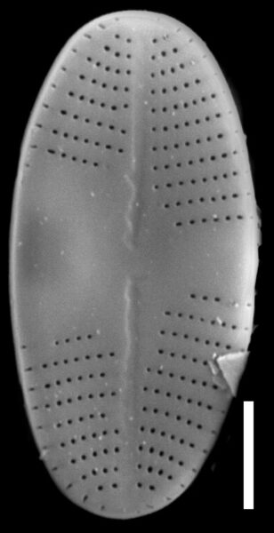 Psammothidium lauenburgianum SEM2