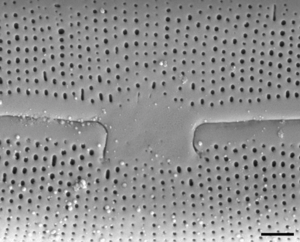 Frustulia capitata SEM1