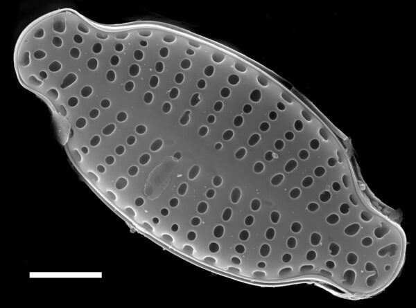 Karayevia laterostrata SEM3