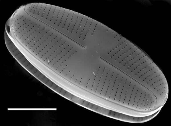 Psammothidium helveticum SEM1