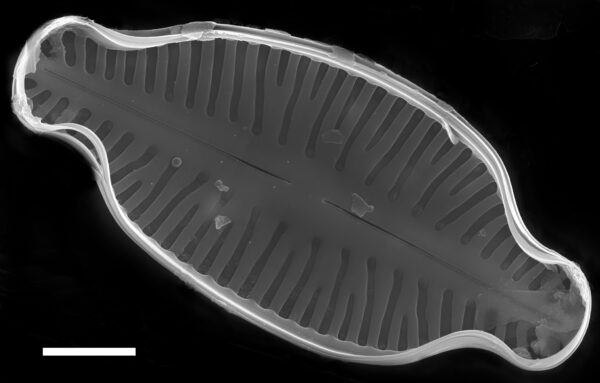 Karayevia laterostrata SEM4