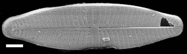 Geissleria punctifera SEM1