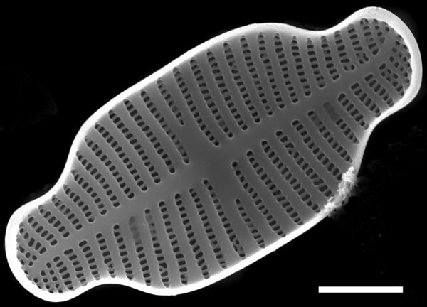 Gogorevia exilis SEM1