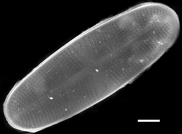 Psammothidium chlidanos SEM2