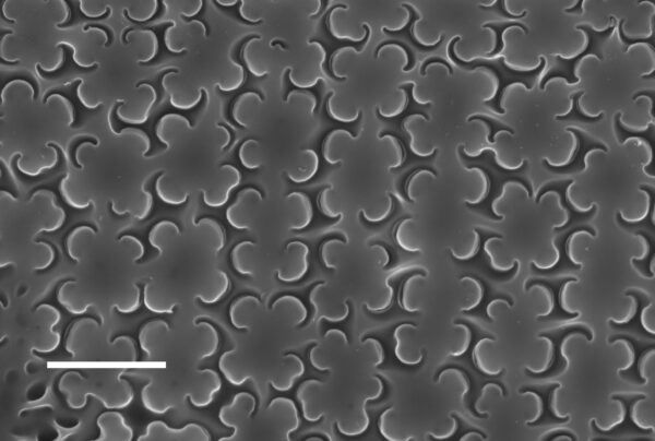 Epithemia adnata SEM1