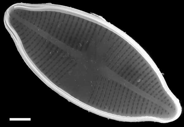 Psammothidium harveyi SEM1