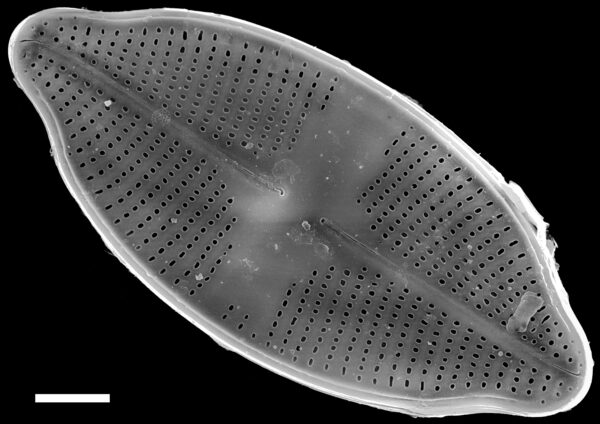 Psammothidium harveyi SEM2