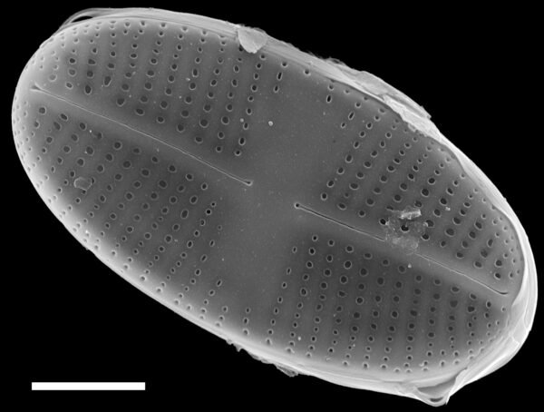 Psammothidium pennsylvanicum SEM3