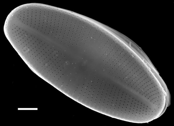 Psammothidium helveticum SEM2