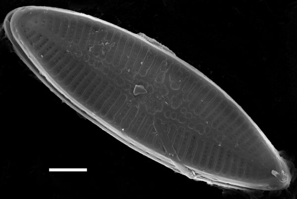 Nupela lapidosa SEM3