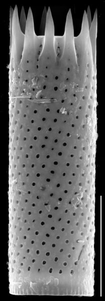 Aulacoseira subarctica SEM1