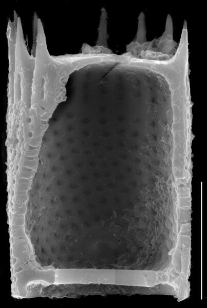 Aulacoseira subarctica SEM3