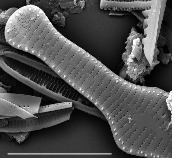 Tabellaria flocculosa SEM1