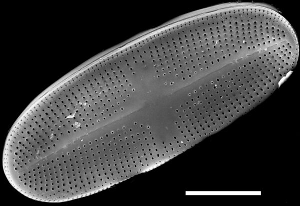 Psammothidium alpinum SEM1