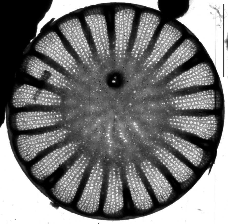 Cyclotella atomus TEM1