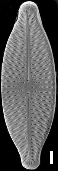 Geissleria lateropunctata SEM2