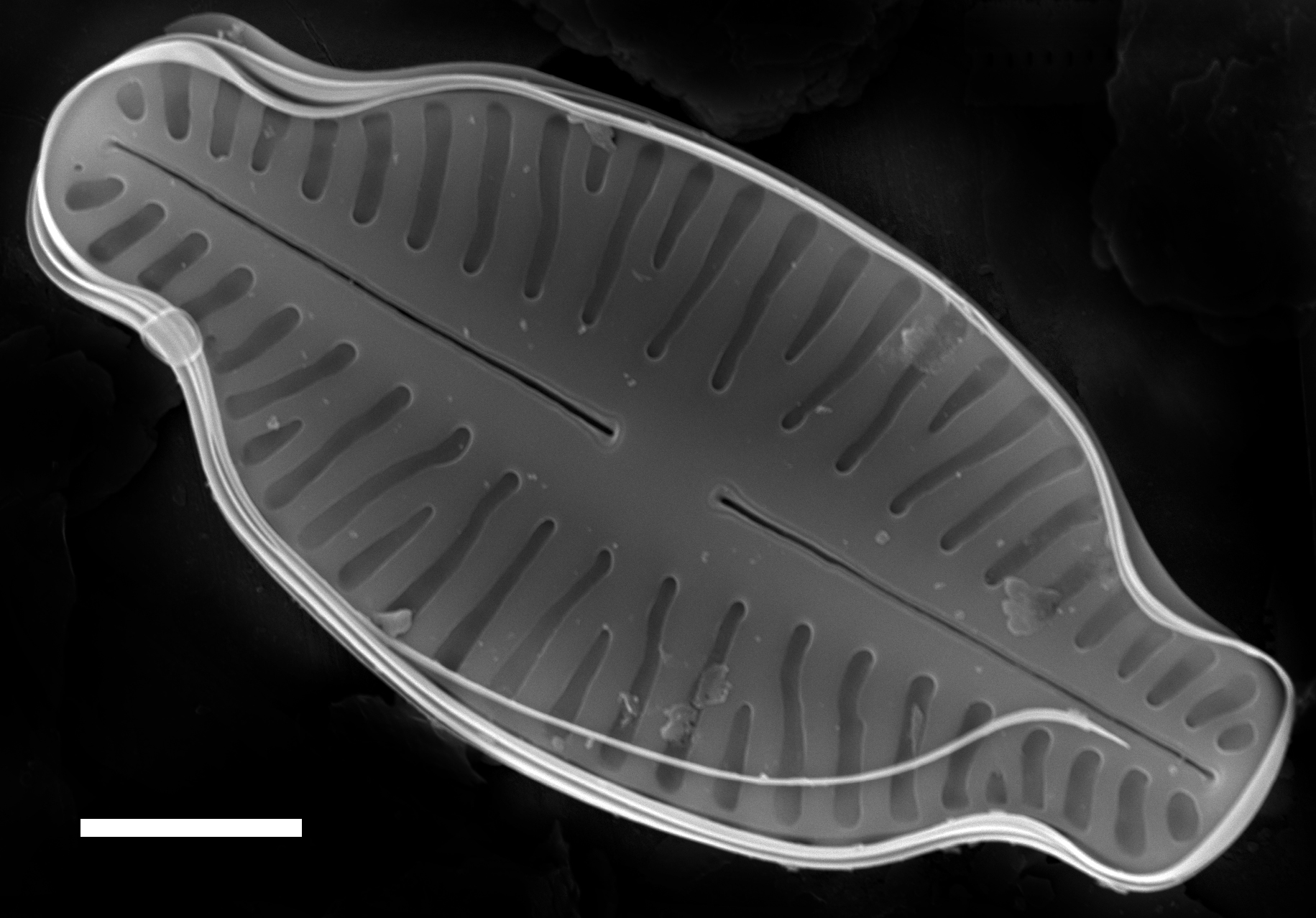 Karayevia laterostrata SEM1