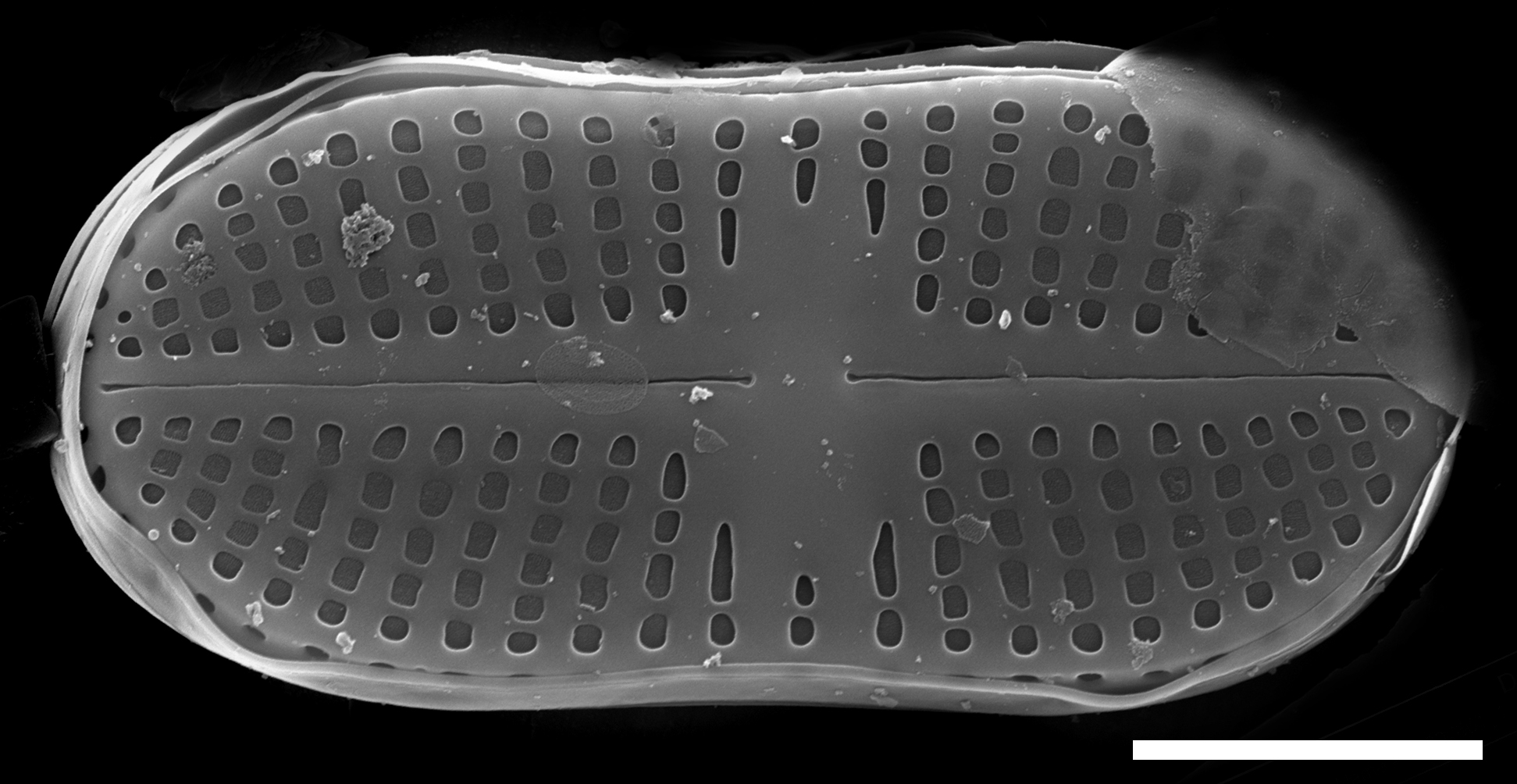 Psammothidium didymum SEM6