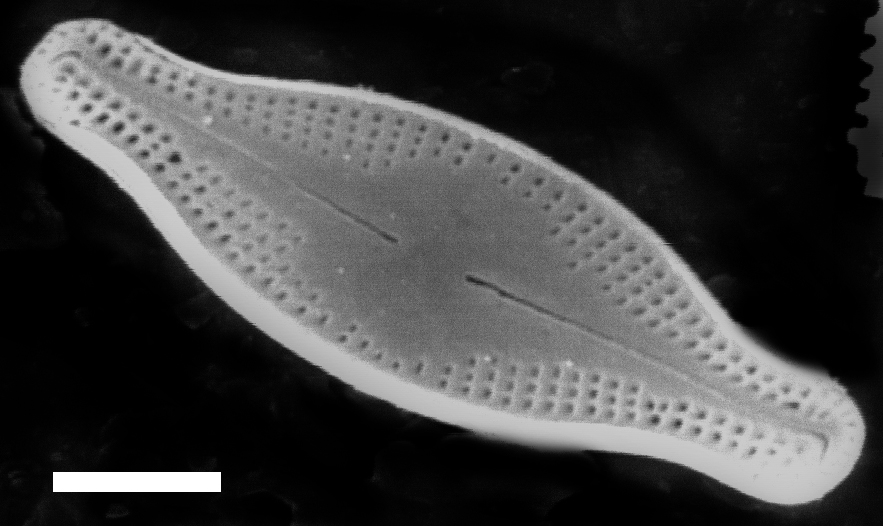 Nupela wellneri SEM1