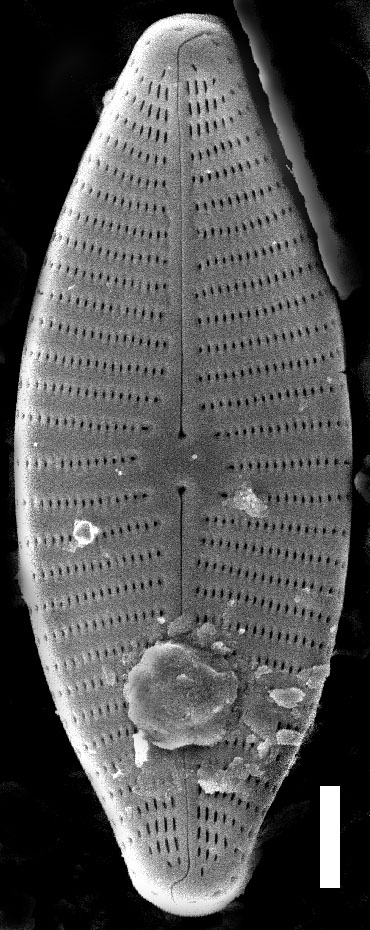 Geissleria kriegeri SEM1