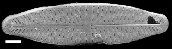 Geissleria punctifera SEM1