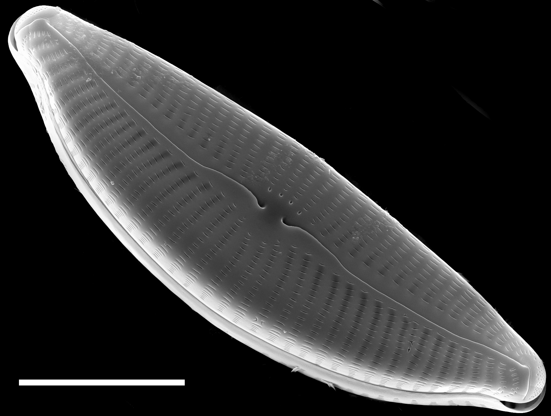 Cymbella turgidula SEM2