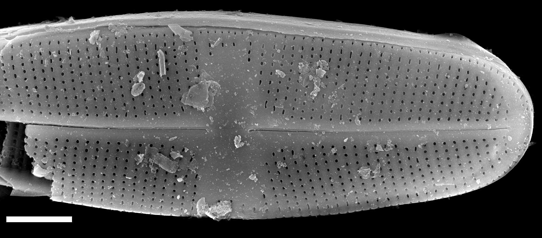 Psammothidium chlidanos SEM1