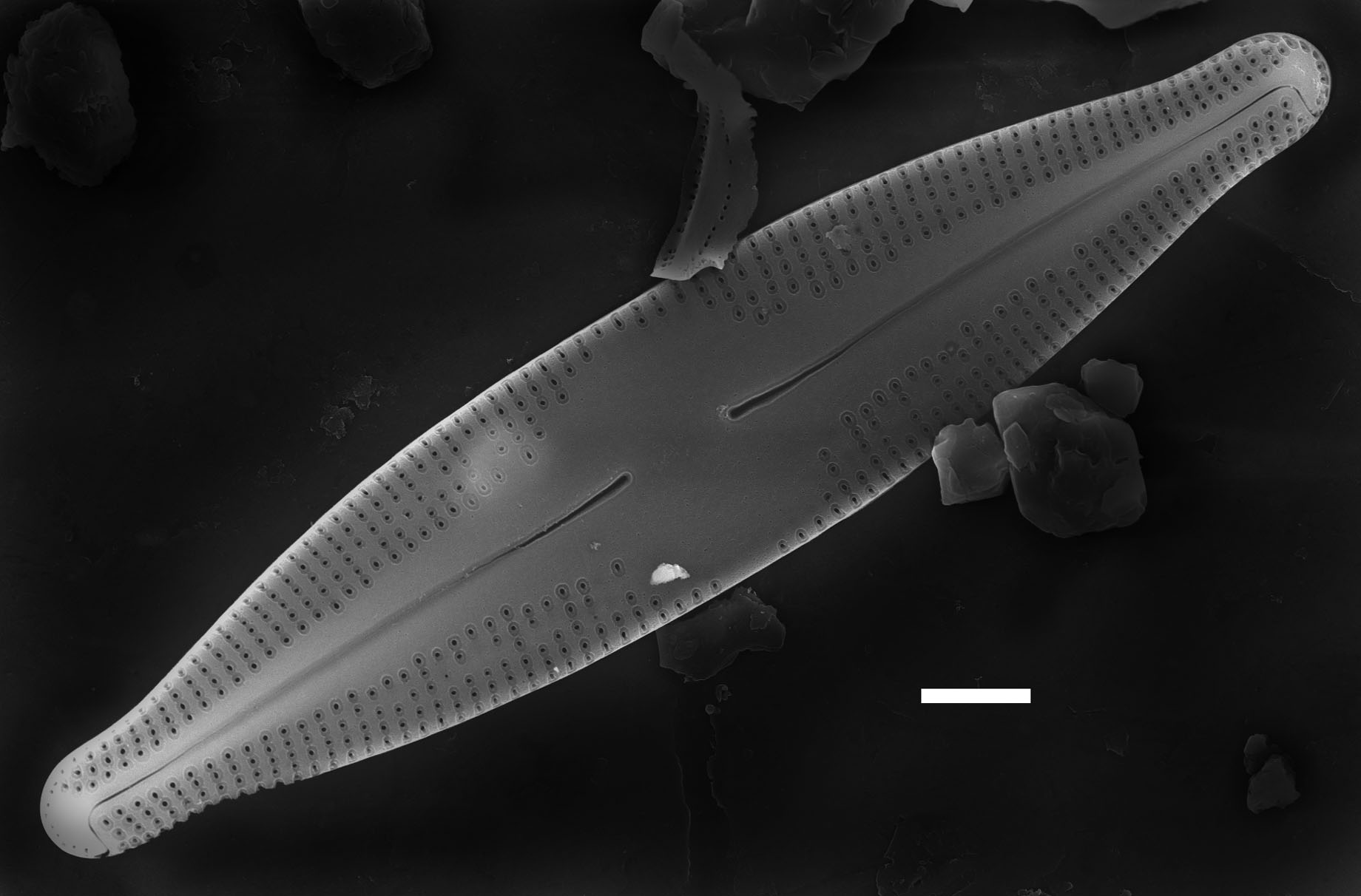 Nupela poconoensis SEM3