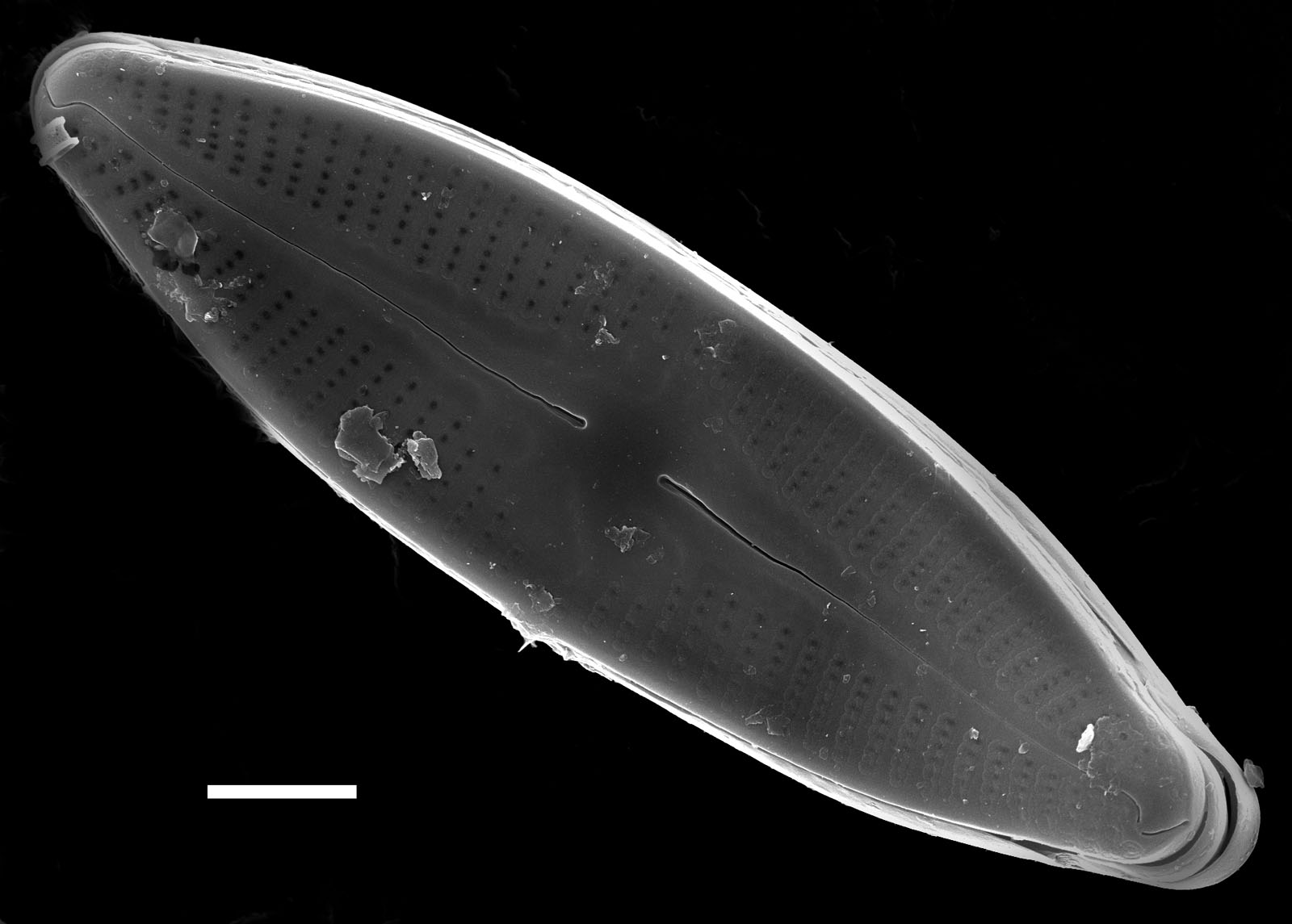 Nupela lapidosa SEM2