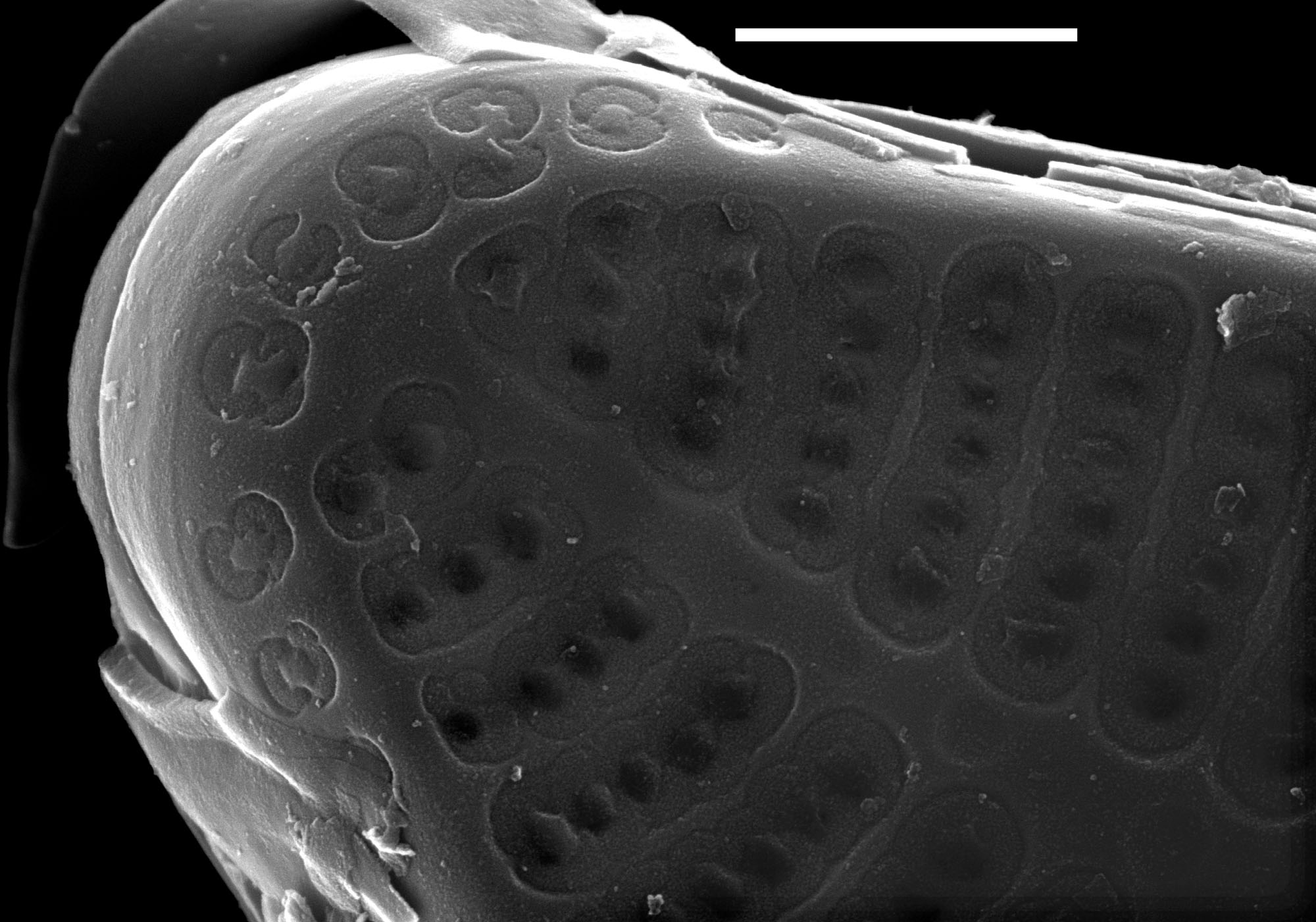 Nupela lapidosa SEM4