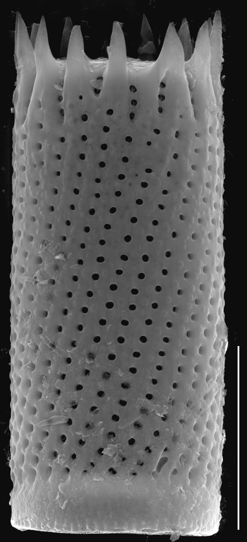 Aulacoseira subarctica SEM2