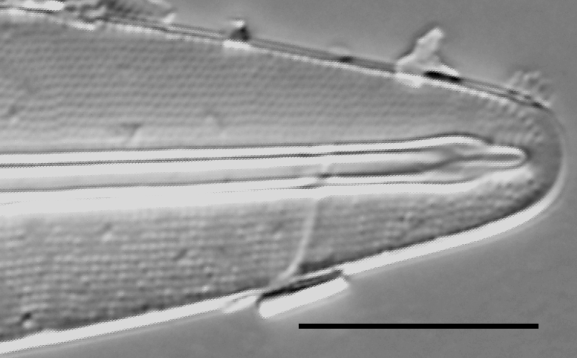 Frustulia krammeri LM1