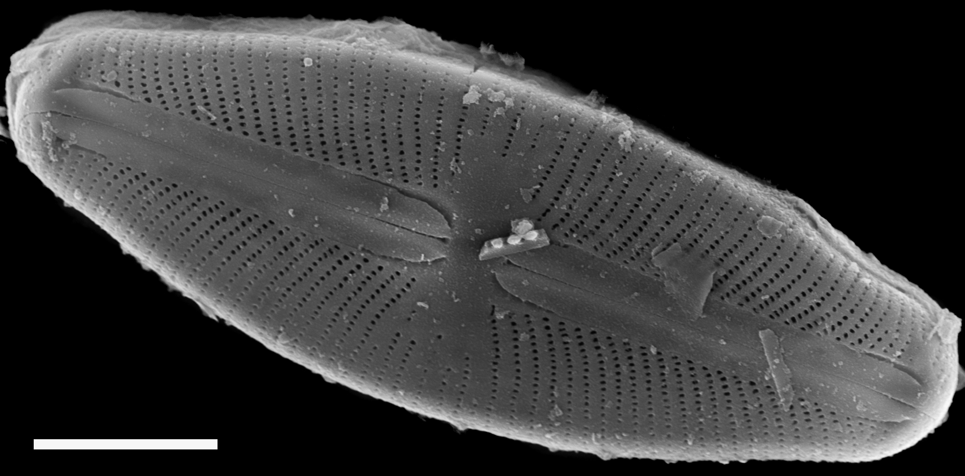 Sellaphora hohnii SEM2