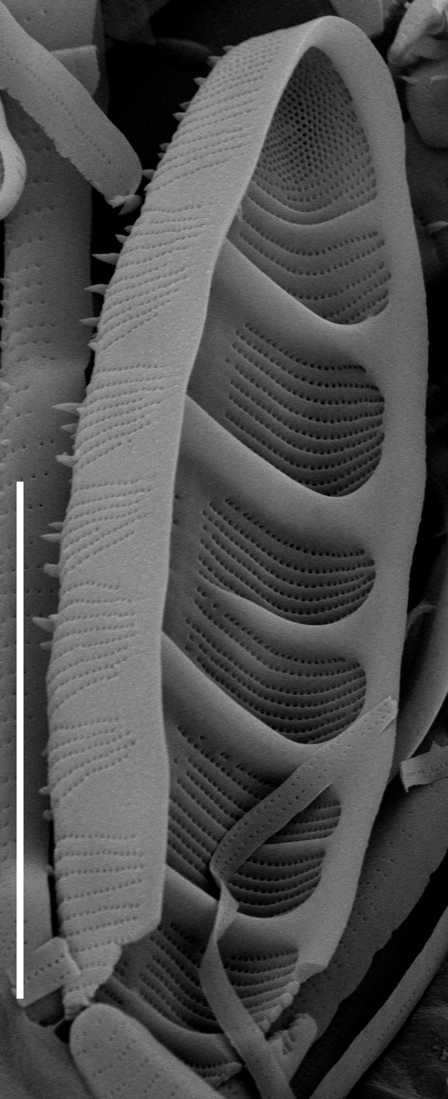 Odontidium hyemale SEM1